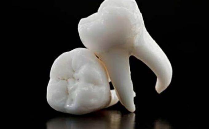 Китайские ученые вырастили зуб из мочи Китайские ученые вырастили зуб из мочи